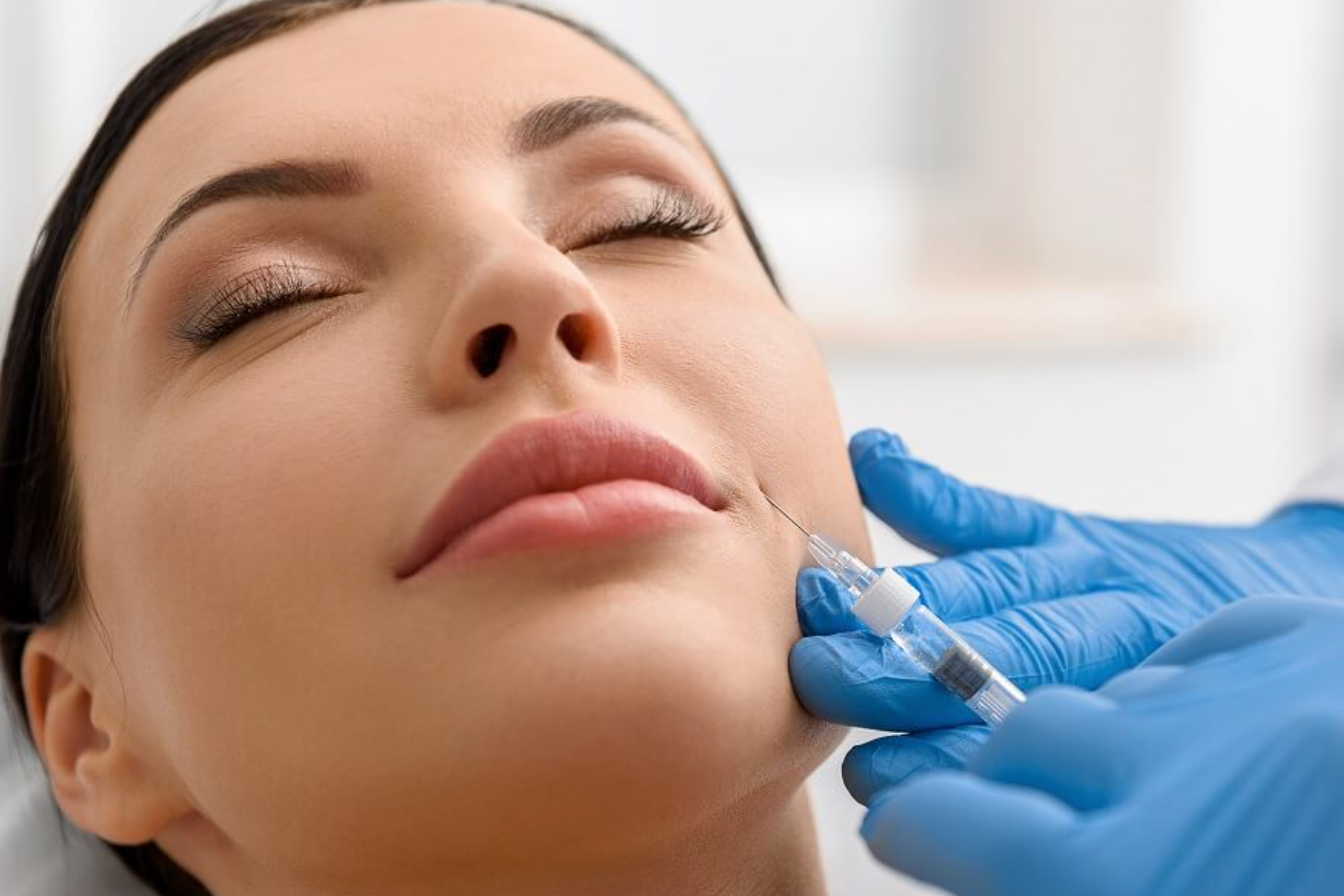Radiesse Filler
